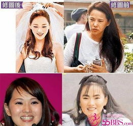 宁静拉皮伊能静脸僵硬40女星真美or假美