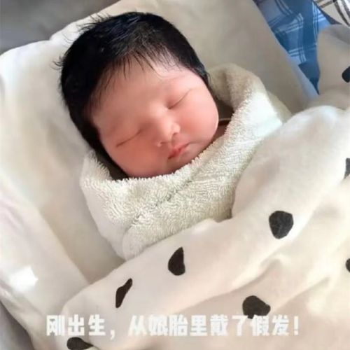 为啥有的宝宝出娘胎就头发茂密,有的快1岁还稀疏发黄